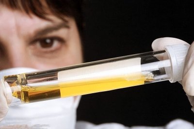 公务员尿检很严格,具体检查哪些?