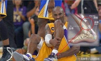 三张图告诉你,跟腱断裂有多恐怖!