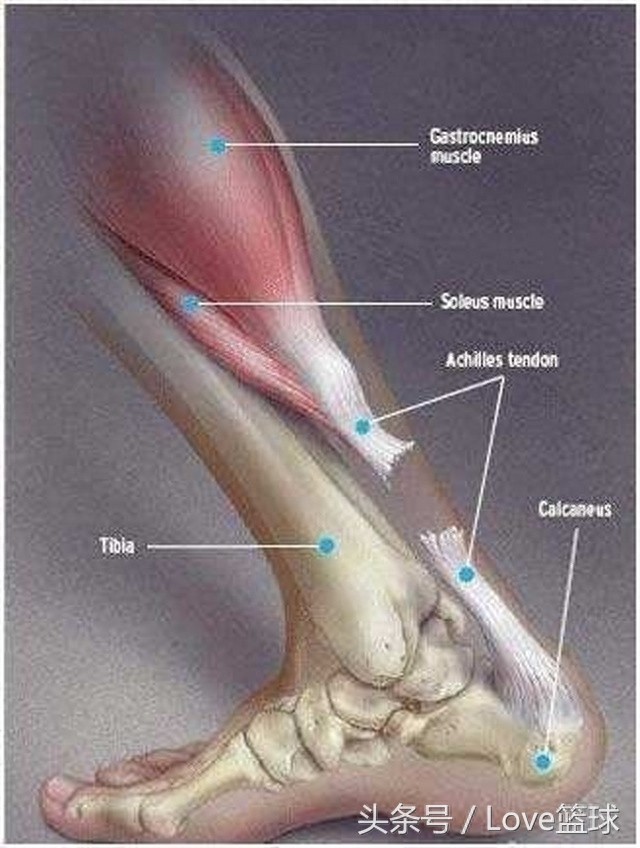 三张图告诉你,跟腱断裂有多恐怖!
