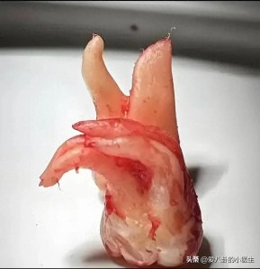 ​你想象不到的——千奇百怪的“智齿”