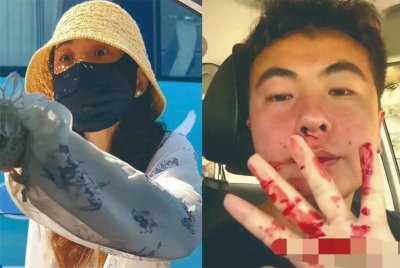 ​血脉偾张的崂山冲突：打人女子为何逃过法律惩罚？