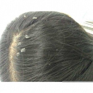 ​哪个牌子的氨基酸洗发水比较好?发根洗发水推荐